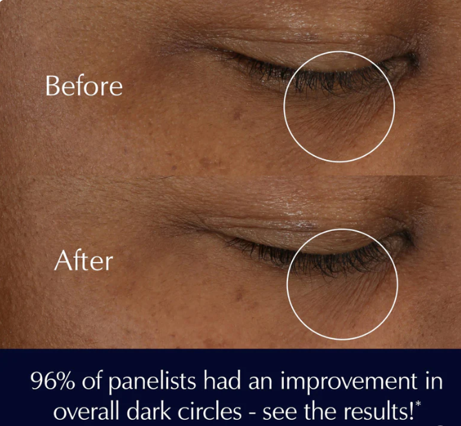 Estée Lauder Advanced Night Repair Eye Supercharged Gel-Creme