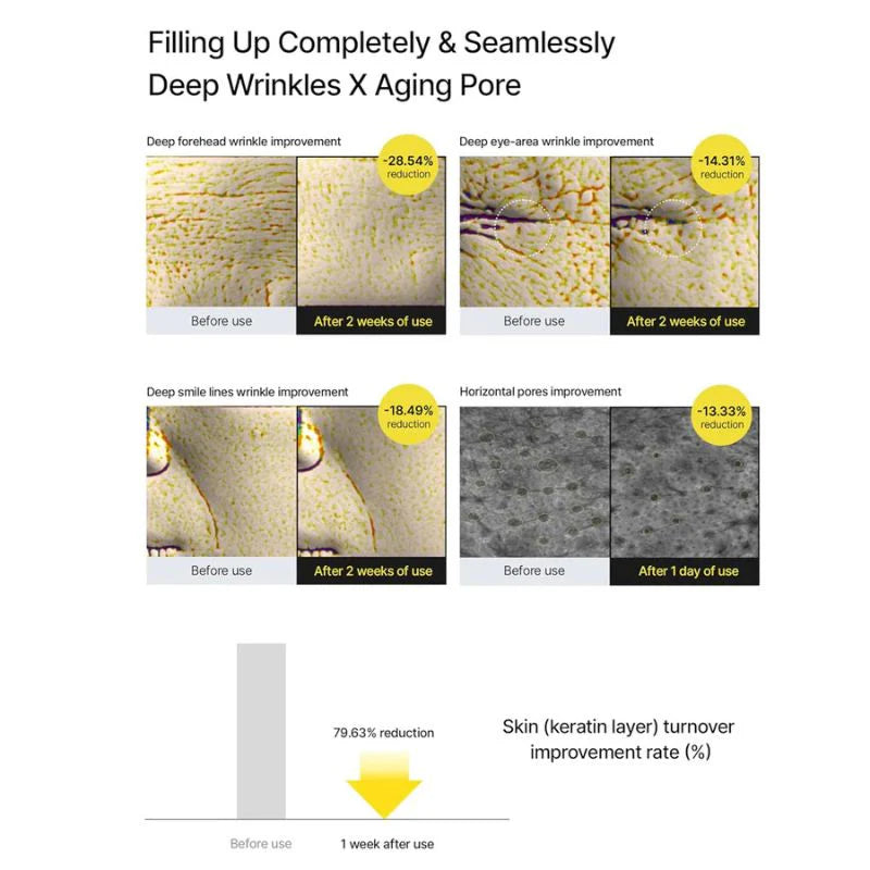 Celimax The Vita A Retinal Shot Tightening Booster | with Retinal 0.1%, Matryxyl 3%, Pore Minimizer, Wrinkles & Fine Lines, Firmer Skin, 15ml